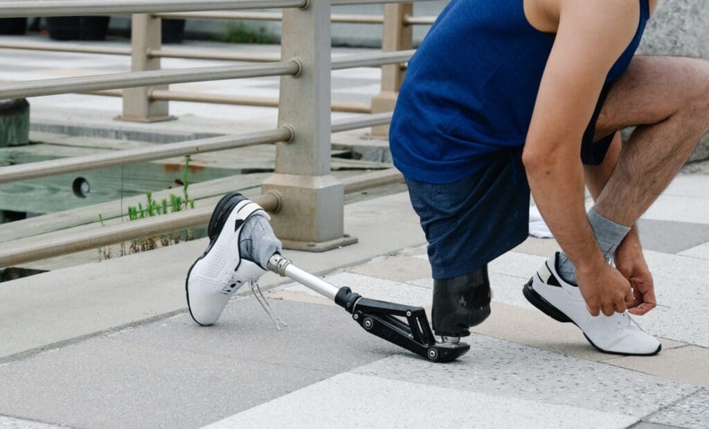 person with prosthetic leg tying shoes