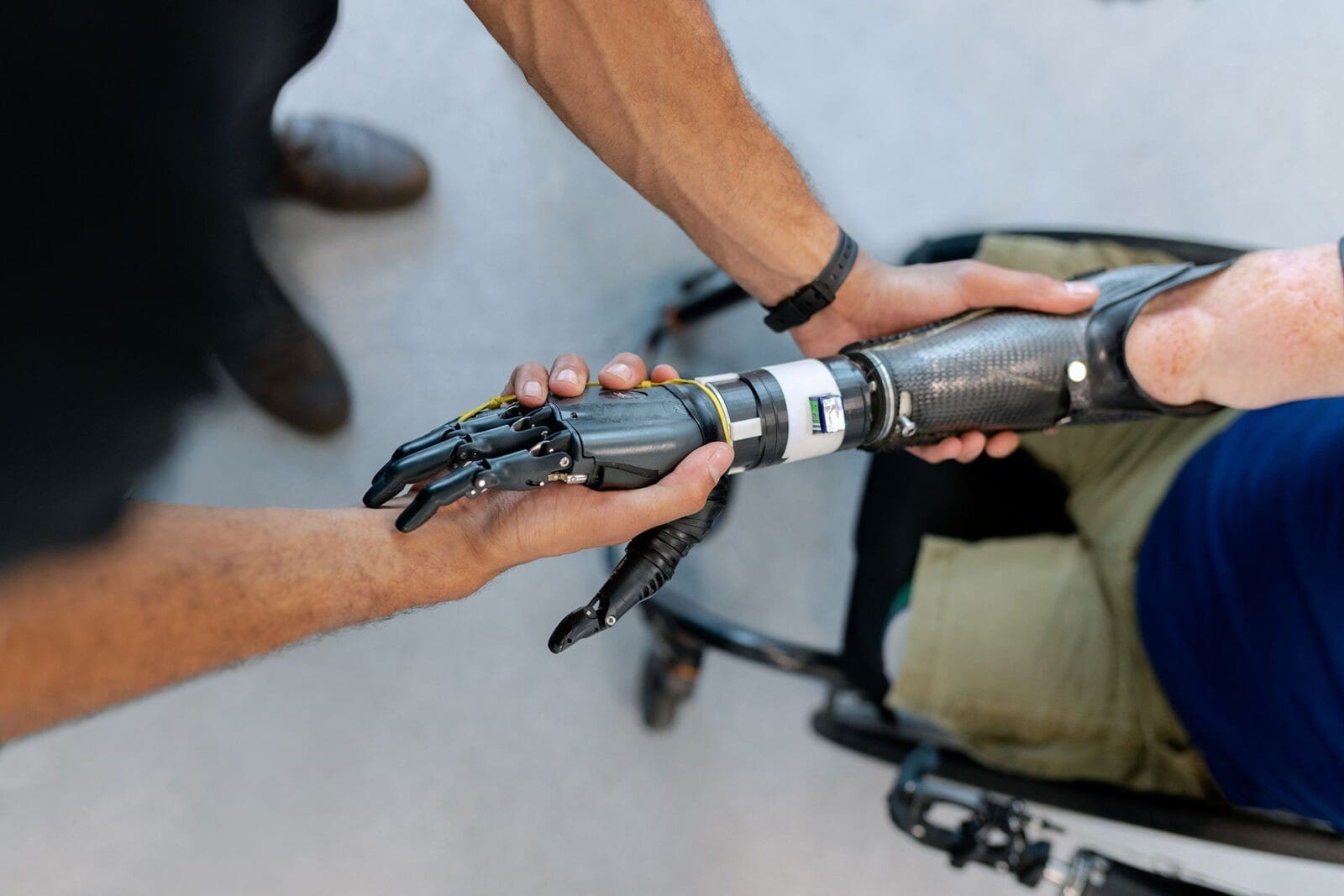 Person shaking hands with someone who uses a prosthetic aid