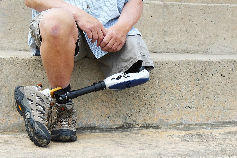 fort worth texas veteran with a disability sits on steps outdoors displaying his prosthetic leg